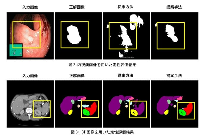 【名城大学】初期段階の⼩さな癌などの⾃動検知に貢献できる可能性－医⽤画像内の領域分割を⾃動で⾏う ＡＩの新しい学習⽅法を提案－