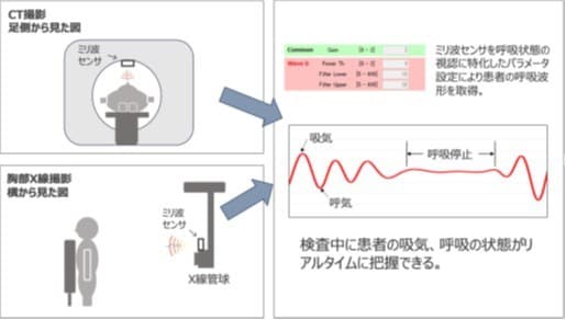 世界初！胸部X線撮影やCT検査時の呼吸状態を非接触で計測　ミリ波センサを用いた新たなモニタリングシステムを開発