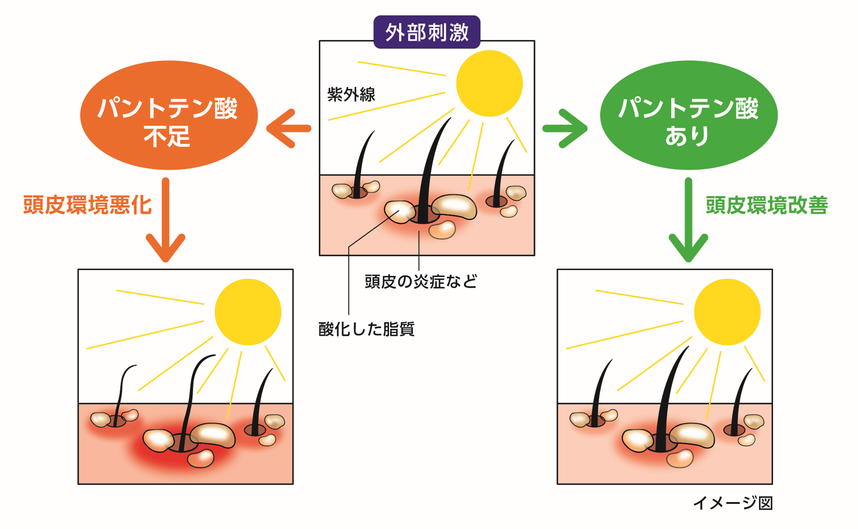 毛髪の成長に欠かせない栄養成分「パントテン酸」が 外部刺激による毛髪の成長阻害を改善する可能性