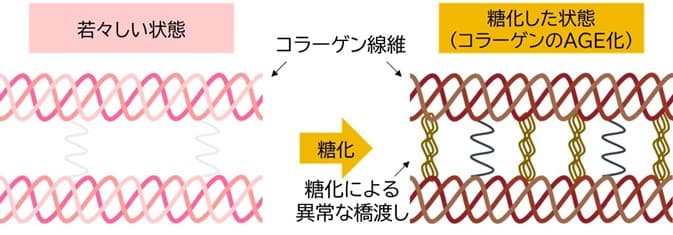 鉄分がコラーゲンと肌細胞の糖化を抑制することを発見