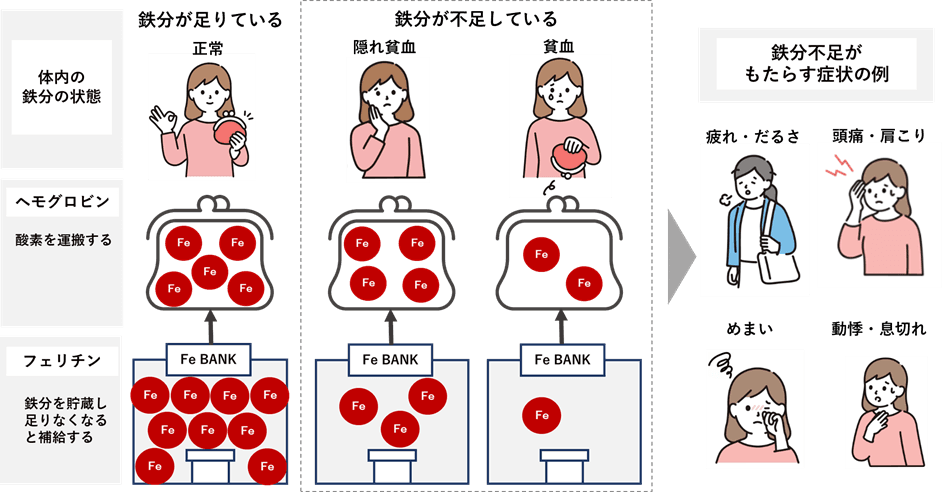 弘前大学・京都大学との共同研究で健康ビックデータから『女性のメンタル不調』に『鉄分不足』が関係していることを確認