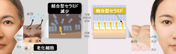 細胞老化が肌のバリア機能に重要な結合型セラミドを減少させる新知見