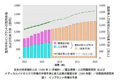 インプラント市場の予測