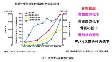 急増する高齢者の骨折