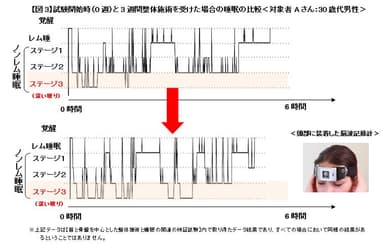 【図3】整体による睡眠図の変化