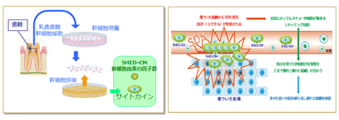 内皮細胞の再生を促す、根源的な治療を行う「SHED-CM」