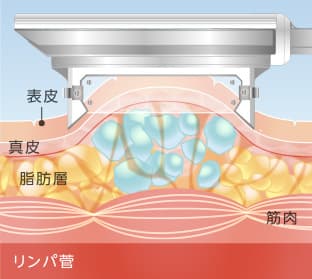 「クールミニ」原理1