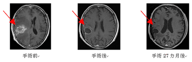 症例1