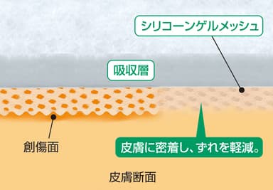 皮膚に密着し、ずれを軽減(イメージ図)