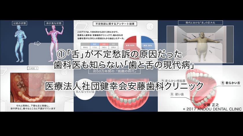 歯科治療で“舌”を健康にして、体の不調を改善　
咬み合わせの研究を牽引する安藤歯科クリニックが解説動画を発表