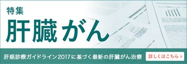 【肝臓がん～肝癌診療ガイドライン2017に基づく最新の肝臓がん治療】