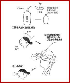 「つらい不調が続いたら慢性上咽頭炎を治しなさい」