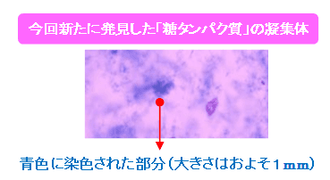 今回新たに発見した「糖タンパク質」の凝集体