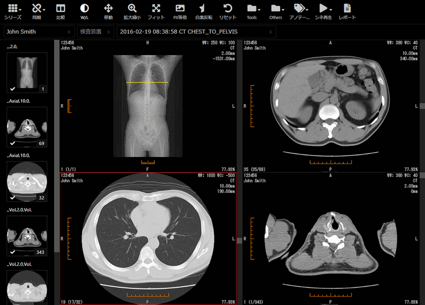 医療機器認証を取得した医療画像管理システム
『SonicDICOM(R) PACS MD』の提供を開始