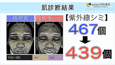 肌診断結果（シミ）