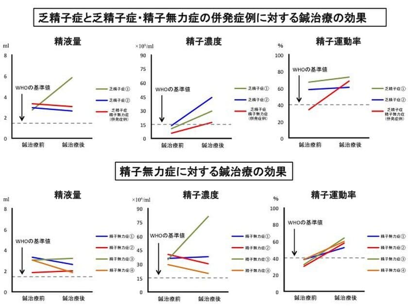 男性不妊症の新規療法として期待される鍼治療が臨床応用段階へ
-京都・「SR鍼灸 烏丸」で新規療法の応用施術を開始-