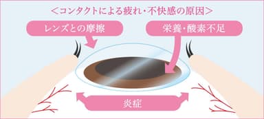 図 コンタクトレンズ装用時の疲れ・不快感の原因(イメージ)