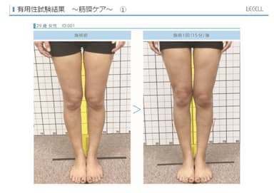 レセル ボディによる有用性試験結果(筋膜リリース)の一例