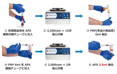 APS精製手順ハイライト