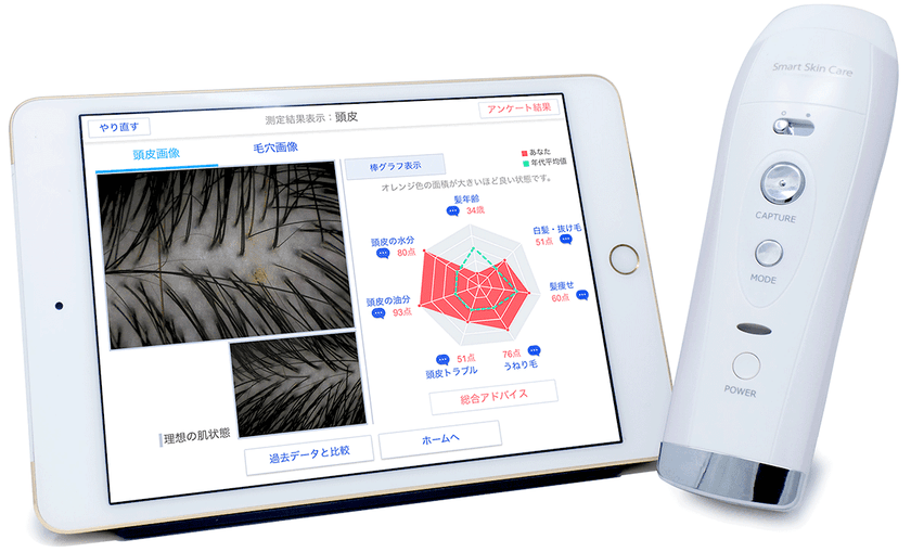 「Smart Skin Care(R)」から
「頭皮・髪チェック」サービスを提供開始
　同一システムにて肌と頭髪の解析／データの管理を実現