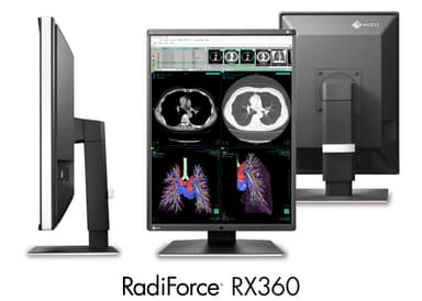 RadiForce RX360