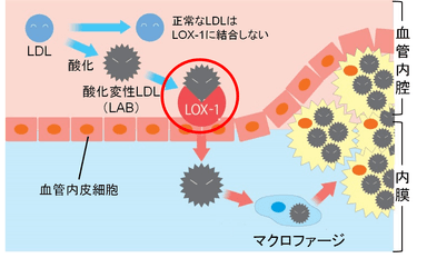 図5　動脈硬化の進行メカニズムとLOX-index