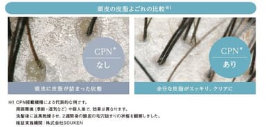 CPNは頭皮環境も整えます