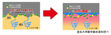 汗によるカブレ発生メカニズム(イメージ図)