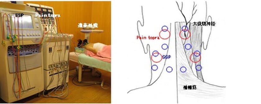 全身の不定愁訴を伴う「むち打ち症」の
病態解明・原因療法確立への突破口