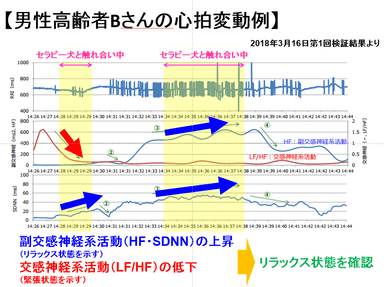 心拍変動測定による自律神経のバランス解析