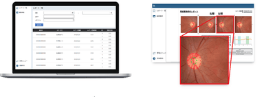 「眼底画像診断支援システム OPTiM Doctor Eye」画面イメージ