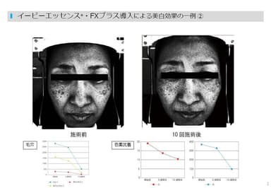 FXプラスの有用性試験結果2