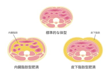 脂肪の付き方