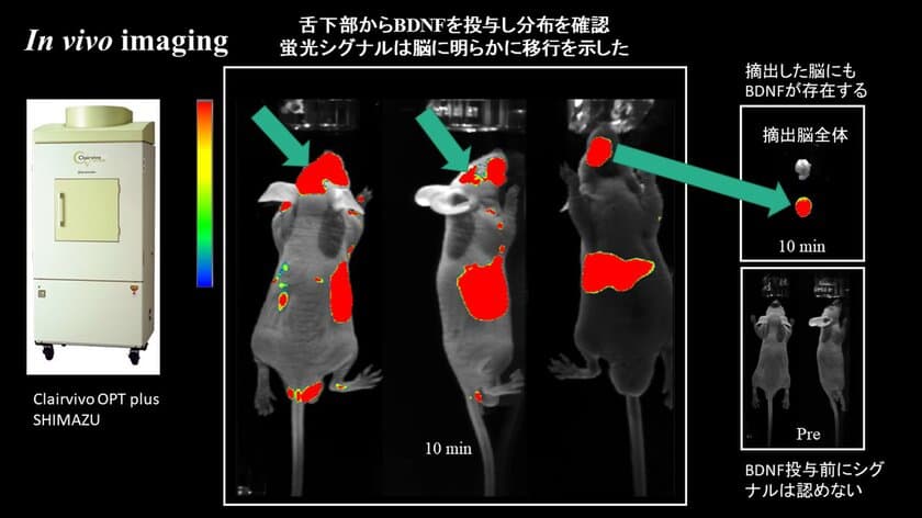 唾液腺、脳に影響を与える臓器であると判明　
唾液中の脳由来神経栄養因子が、抗不安作用を示すと発表