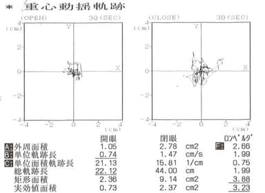 重心動揺平衡機能検査2