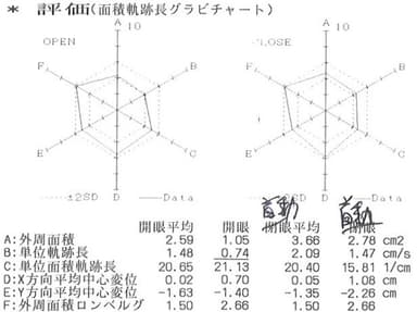 重心動揺平衡機能検査3