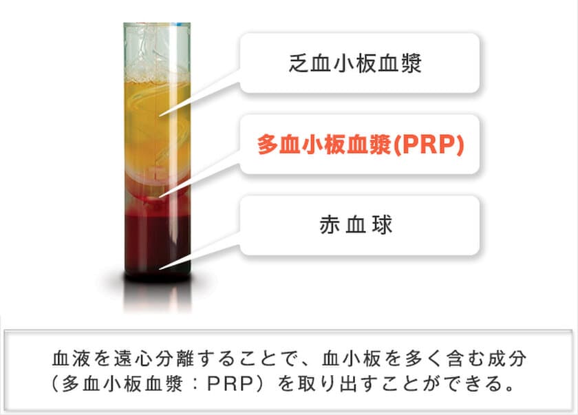 自分の血液を使った細胞治療　
APS療法導入施設数 販売開始から約1年間で「100施設」を突破