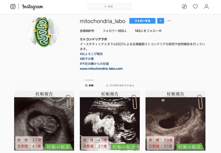 卵子の老化、若返りの重要細胞として注目されているミトコンドリア
　そのATP(エネルギー)生成に関与する電子伝達に電子を供給する
イースタティックミネラルES-27の症例報告が
Instagramで979症例を突破