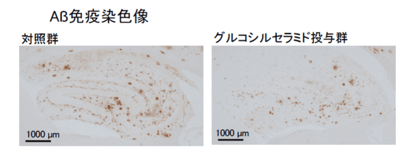 こんにゃくセラミドの摂取による
アルツハイマー病の発症予防効果を確認