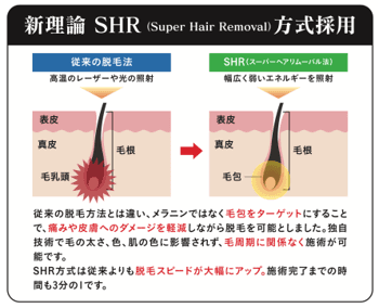 SHR方式図