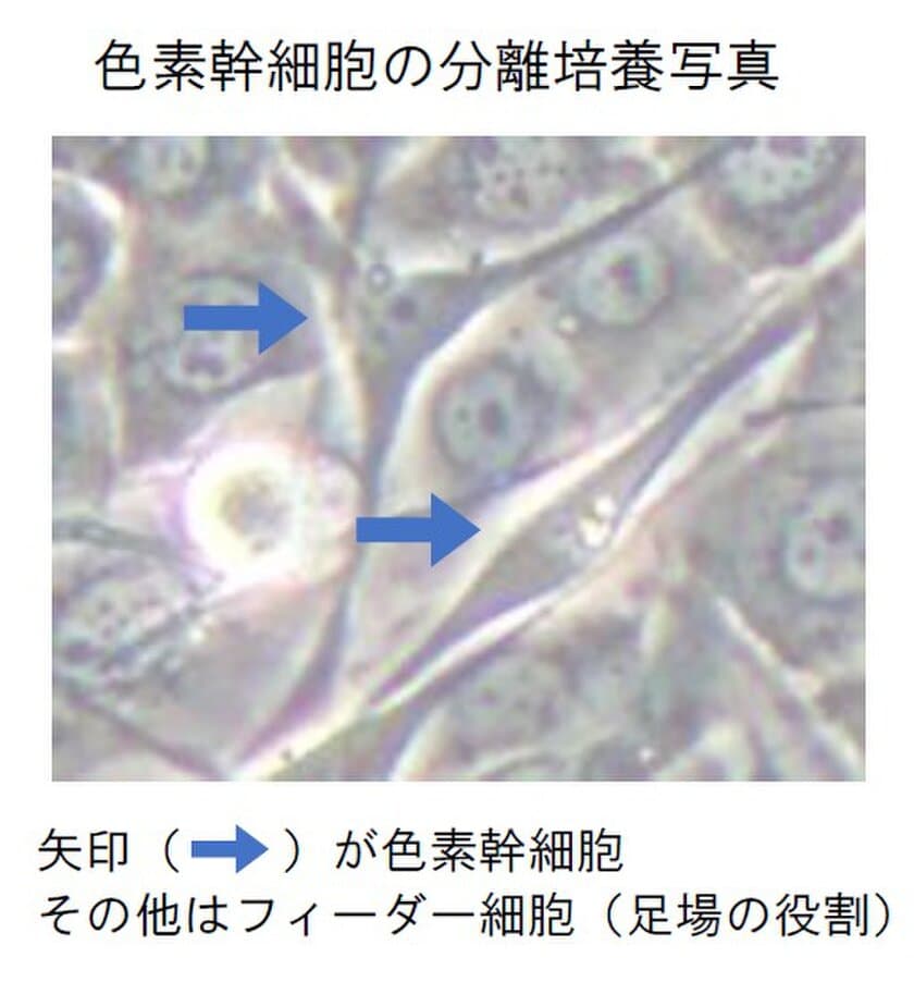 ヒトの皮膚から色素幹細胞の分離培養技術を確立！
～これまで困難であった色素異常の発症メカニズムの解明に期待～