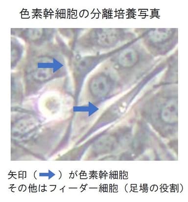 色素幹細胞の分離培養写真