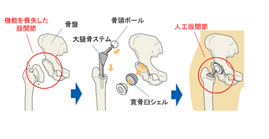 イメージ図