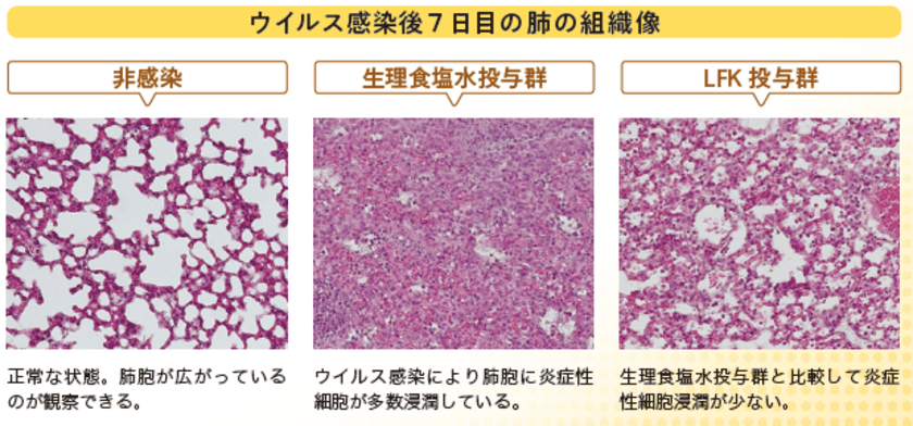 乳酸菌がウイルス性肺炎を抑制、免疫力の向上にも有効
　～北海道大学との共同研究により
酵素処理乳酸菌素材LFKで肺炎抑制効果を確認、特許取得済～