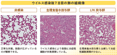 ウイルス感染後の肺の組織像