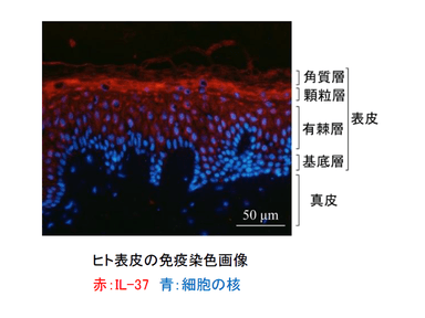 ヒト表皮のIL-37染色