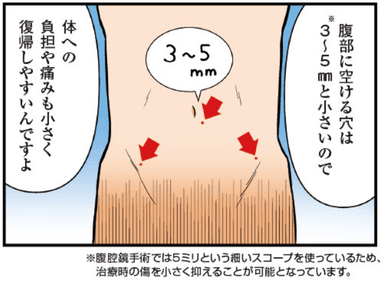 日帰り腹腔鏡手術3