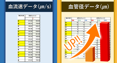 2020年8月21日に血流を測定したデータ