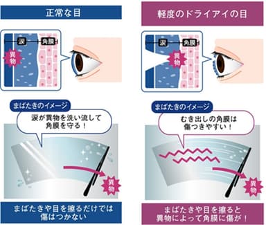 角膜の傷がつくメカニズム