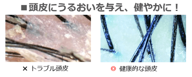 [図2]頭皮にうるおい